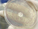У Німеччині 200 нових випадків зараження E.coli