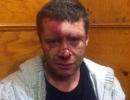 В Одесі жорстоко побили опозиційного активіста