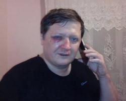 Редактора запорізького опозиційного видання побила місцева «Самооборона Майдану»