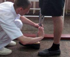 В уряді визнали, що сотням покалічених вояків «АТО» потрібно протезування