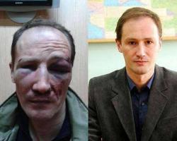 В Одесі побили історика, який доводив, що місту Одеса 600 років