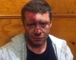 В Одесі жорстоко побили опозиційного активіста
